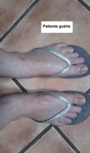 Patiente guerie